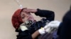 سازمان بهداشت جهانی در مورد شیوع وبا در یمن هشدار داد
